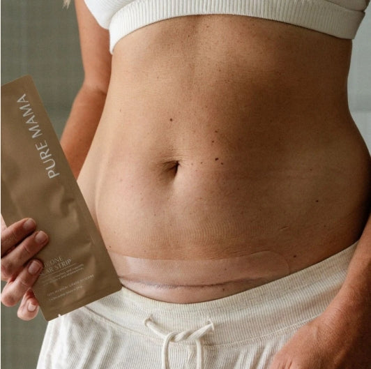 Pure Mama - NEW Silicone Scar Strip