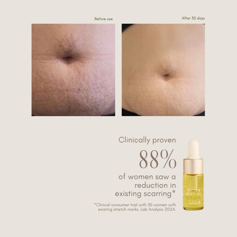 Pure Mama - Belly + Body Oil Mini 10ml
