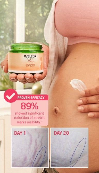 Weleda - Stretch Mark Body Butter