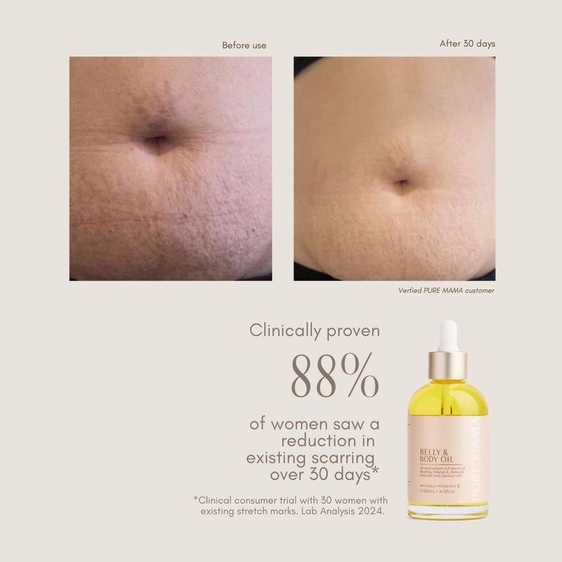 Pure Mama - Belly + Body Oil