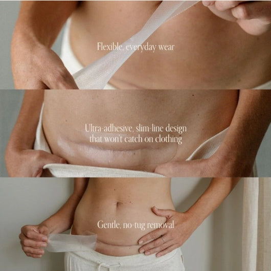 Pure Mama - NEW C-Section Scar Care Kit