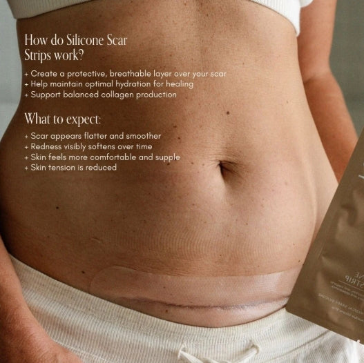 Pure Mama - NEW C-Section Scar Care Kit