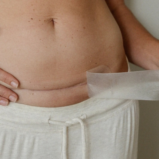 Pure Mama - NEW C-Section Scar Care Kit